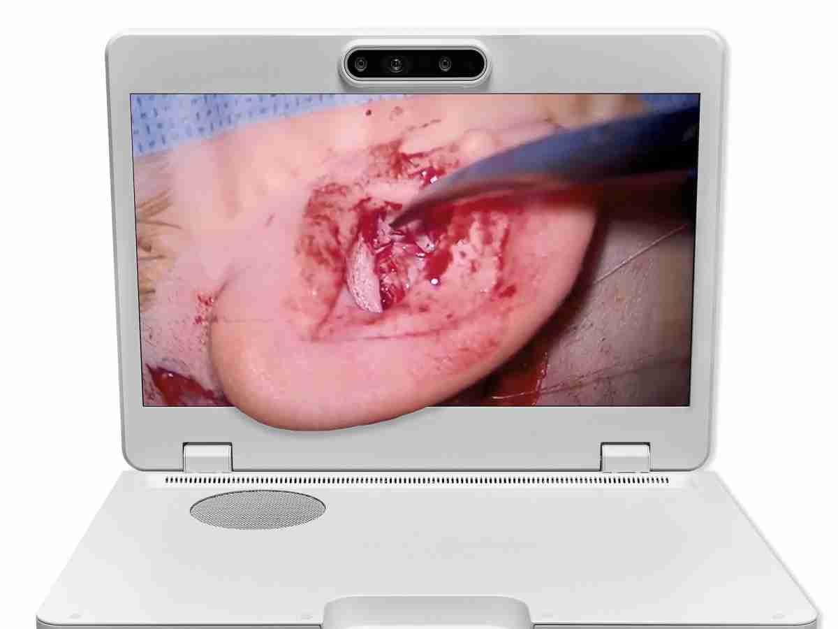 达擎之＂Heads-up 3D显微手术显示系统＂，，，整合4K裸眼3D显示及眼球追踪系统，，具备快速追踪人眼移动位置功能，，减轻医师长时间维持固定姿势的负担，，，让医师能有更宽广清晰的3D立体视野及更舒适的姿势来执行手术。。。